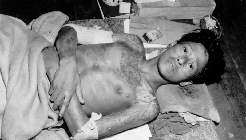 80 Yıl Sonra Nagasaki'den Haykırış: Nükleer Tehdit Yeniden Ortaya Çıktı